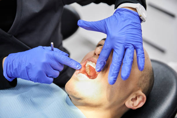 Best Emergency Treatment for Oral Infections in Toppenish, WA