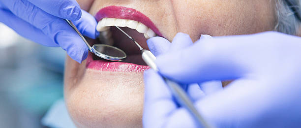 Best Emergency Cosmetic Dentistry (e.g., broken veneers) in Toppenish, WA