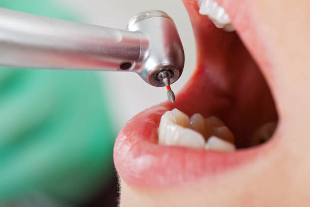 Best Emergency Dental Care for Sports Injuries in Toppenish, WA